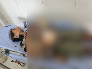 Pria Diduga Coba Bunuh Diri di Area Mall Borobudur, Polres Jayapura Lakukan Penanganan Cepat